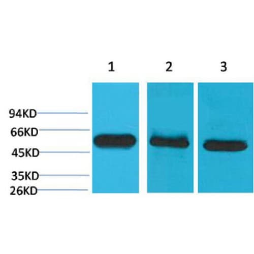 CASP8 / Caspase 8 Antibody (clone 2G12)