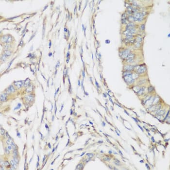 SH3GLB2 / Endophilin-B2 Antibody