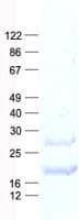 Human NAF-1 / CISD2 Protein (Recombinant His, N-Terminal)