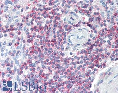IHC-plus™ Polyclonal Rabbit anti-Human SLAMF6 / NTBA Antibody (IHC)