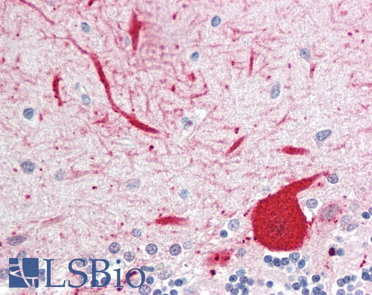 IHC-plus™ ALDOC / Aldolase C Antibody (clone IgG1, k)