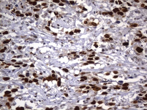 MSH2 Antibody (aa1-304, clone UMAB259)