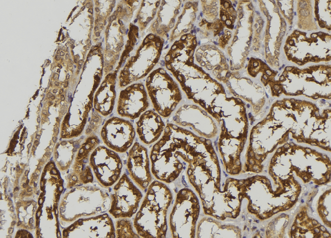 GALM / Mutarotase Antibody