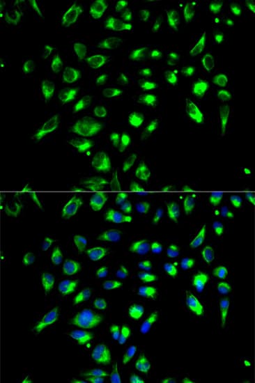 IHC-plus™ Polyclonal Rabbit anti-Human CD86 Antibody (IHC, IF, WB)