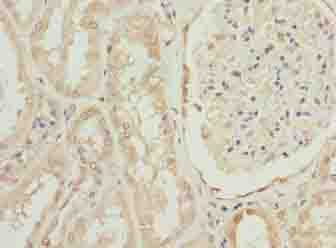 Polyclonal Rabbit anti-Human OVOL1 Antibody (IHC, WB)