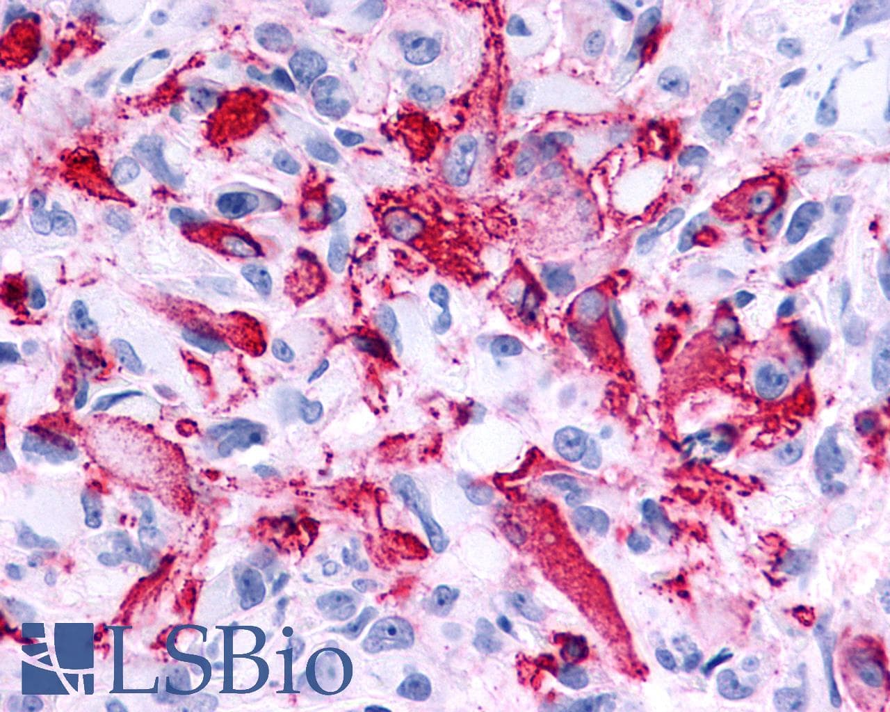 PathPlus™ Polyclonal Rabbit anti-Human RXFP2 / LGR8 Antibody (Cytoplasmic Domain, IHC, WB)
