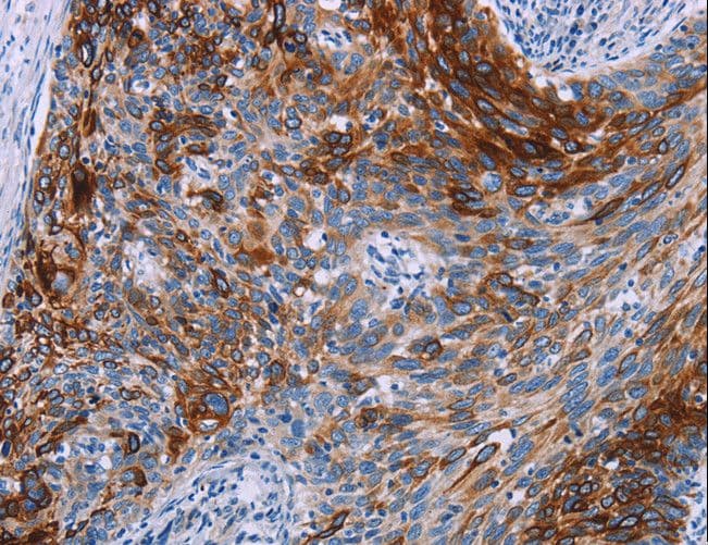 Polyclonal Rabbit anti-Human KRT14 / CK14 / Cytokeratin 14 Antibody (IHC, WB)