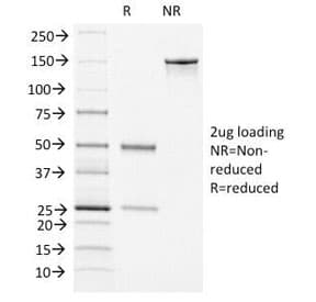 VWF / Von Willebrand Factor Antibody (clone VWF/1465)