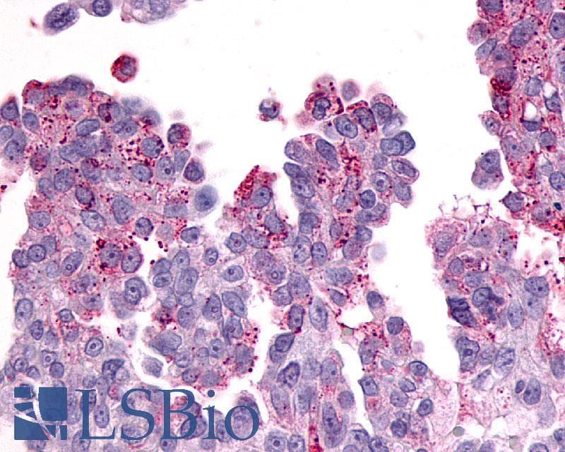 IHC-plus™ Polyclonal Rabbit anti-Human PTGER3 / EP3 Antibody (Cytoplasmic Domain, IHC)