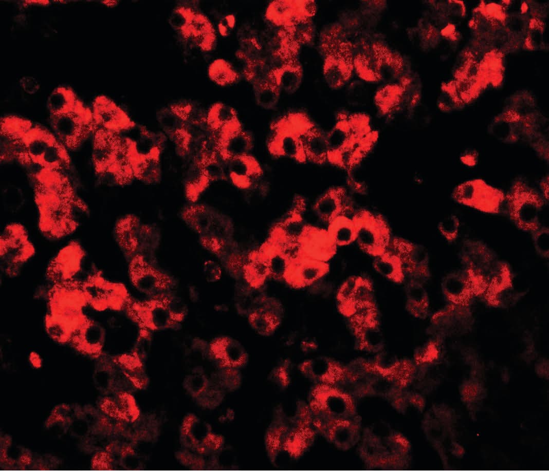 IHC-plus™ Polyclonal Rabbit anti-Human TMEM135 Antibody (IHC, IF, WB)