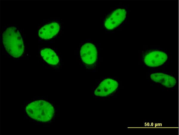 IHC-plus™ Monoclonal Mouse anti-Human GTF2I / TFII I Antibody (clone 3E2, IHC, IF, WB)