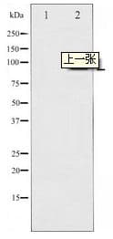 RPS6KA5 / MSK1 Antibody