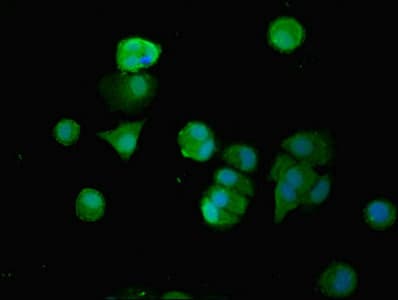 Polyclonal Rabbit anti-Human SMG6 Antibody (aa251-511, IHC)