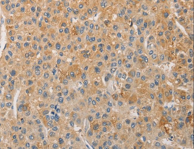 TCF11 / NFE2L1 Antibody