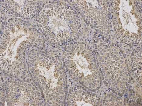 Polyclonal Rabbit anti-Human ARRB1 / Beta Arrestin 1 Antibody (IHC, IF, WB)