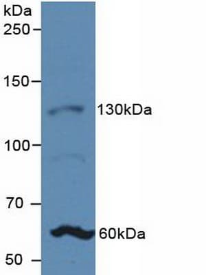 JAG1 / Jagged 1 Antibody (aa33-250)