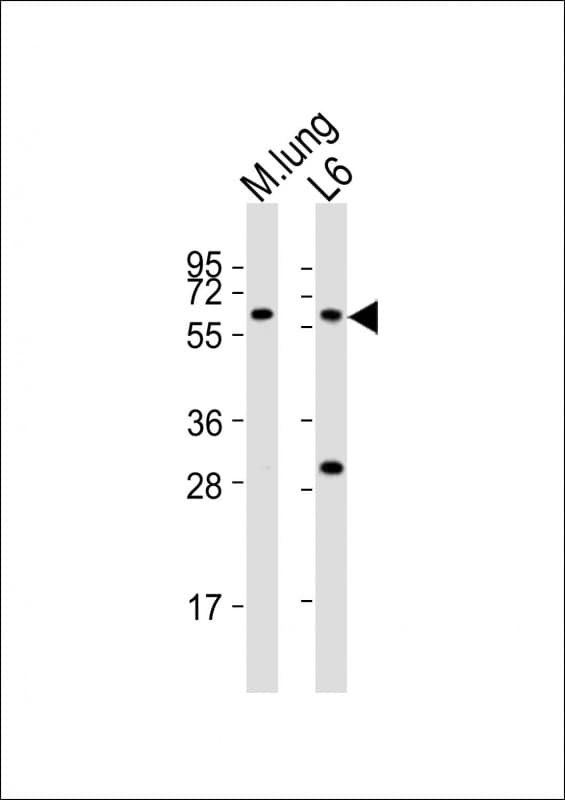 YES1 / c-Yes Antibody (aa148-182)