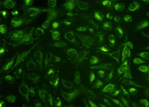 IHC-plus™ NUCB1 / Nucleobindin Antibody (clone 1H8-2C11)