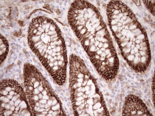 Monoclonal Mouse anti-Human EPLIN Antibody (clone OTI9F3, Carrier-free, aa1-275, IHC, WB)