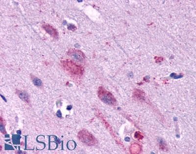 PathPlus™ FFAR1 / GPR40 Antibody (C-Terminus)