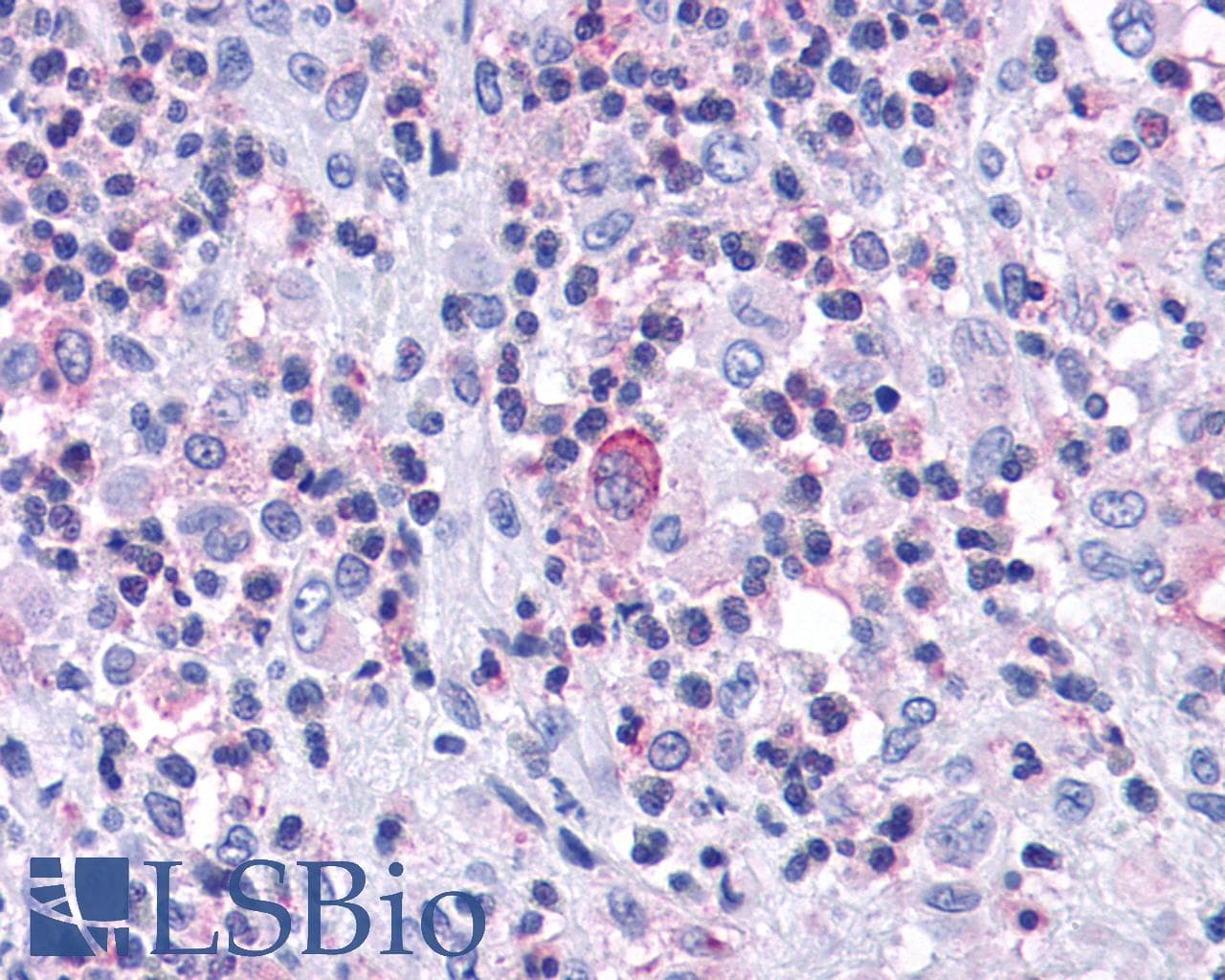 PathPlus™ CCR7 Antibody (C-Terminus)