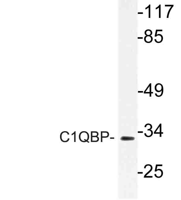 GC1qR / C1QBP Antibody (Lys100)