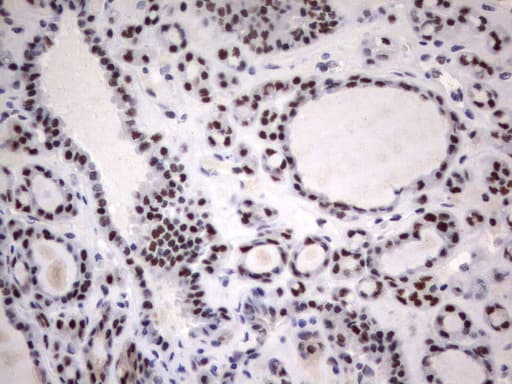 PARN Antibody (aa1-266, clone UMAB143)