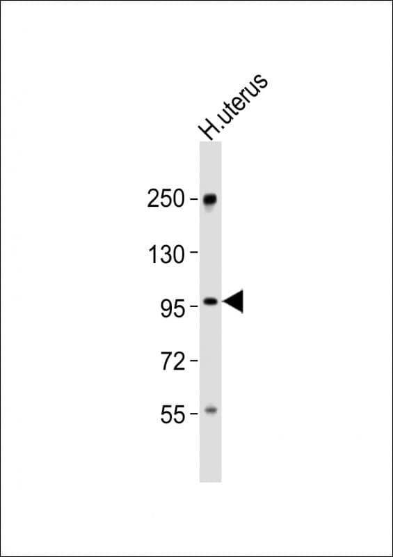 CHSY3 / CSS3 Antibody (aa751-785)