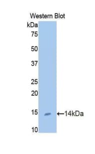 UCN / Urocortin Antibody (aa31-121)