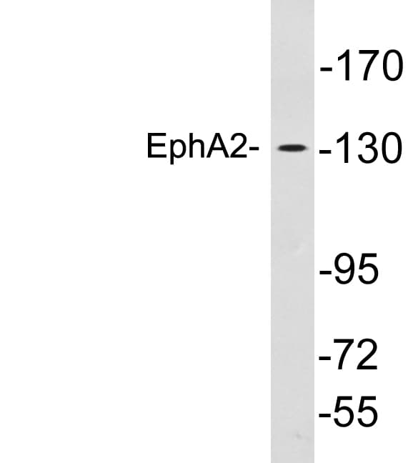 EPHA2 / EPH Receptor A2 Antibody (aa533-582)