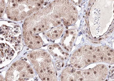 PRKAB1 / AMPK Beta 1 Antibody (phospho-Ser181)