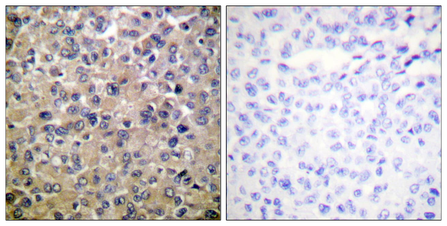 PPP1CA / PP1-Alpha Antibody (aa281-330)