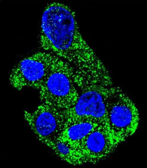 SH2D4B Antibody (aa374-402)