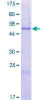Human NUS1 Protein (Recombinant GST)