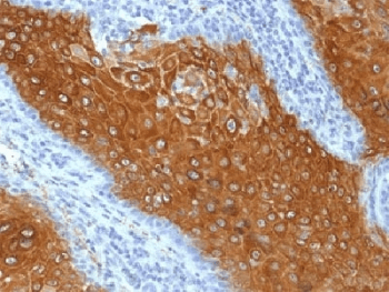 KRT10 / CK10 / Cytokeratin 10 Antibody (clone KRT10/844)