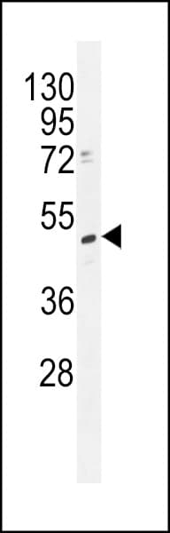 Polyclonal Rabbit anti-Human TRMT2B Antibody (aa136-165, IHC, WB)