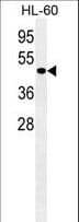 ATG4D Antibody