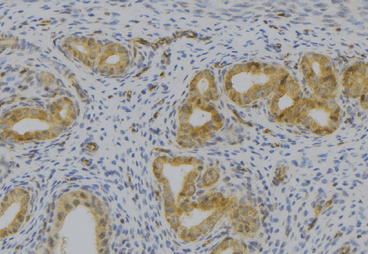 KLKB1 / Plasma Kallikrein Antibody