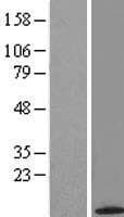 ACYP2 Protein (Over-Expression Lysate Myc-DDK (Flag))