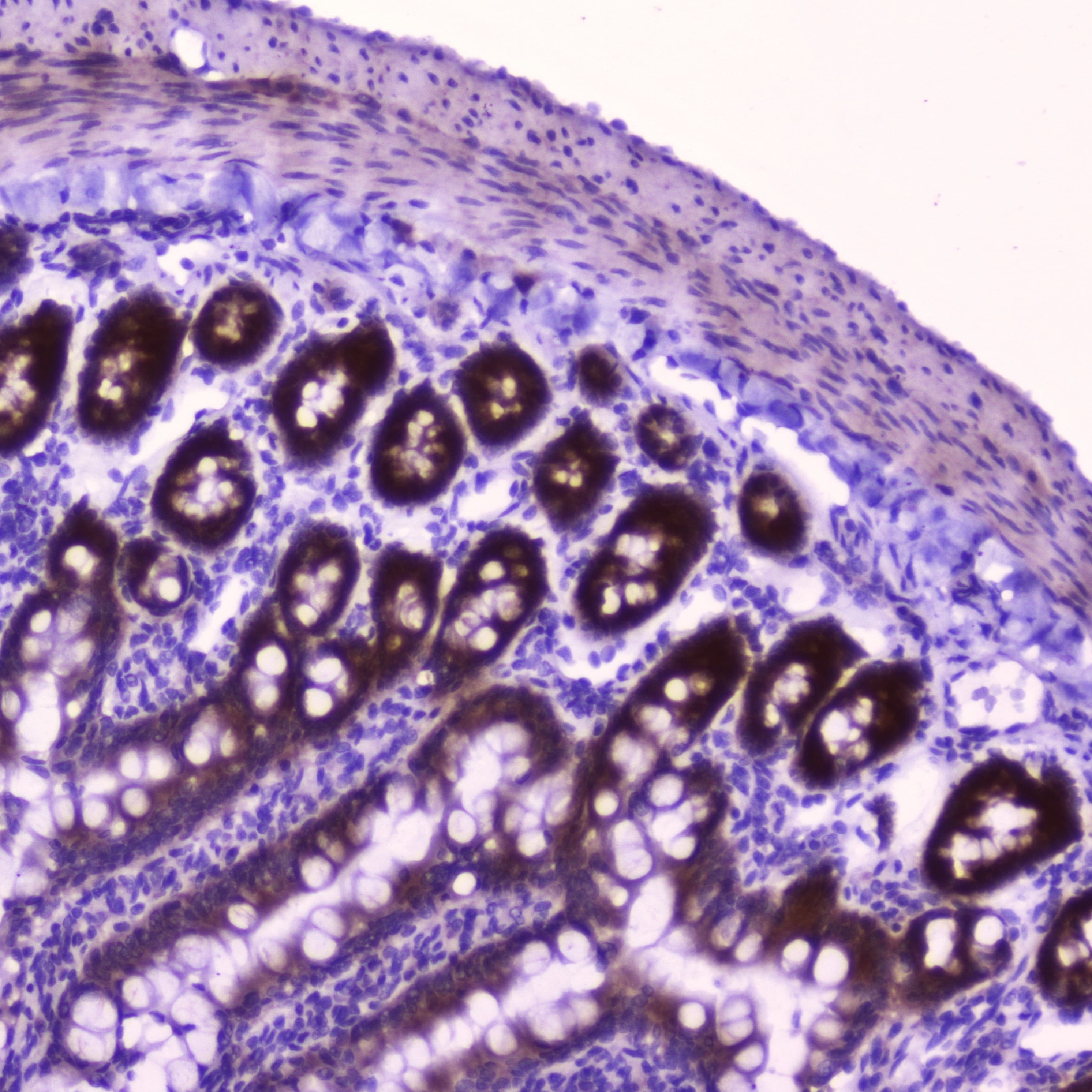 CFLAR / FLIP Antibody