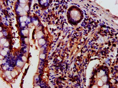 PRKCH / PKC-Eta Antibody
