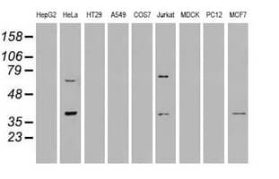 Monoclonal Mouse anti-Human MRI1 Antibody (clone OTI6G9, IHC, IF, WB)