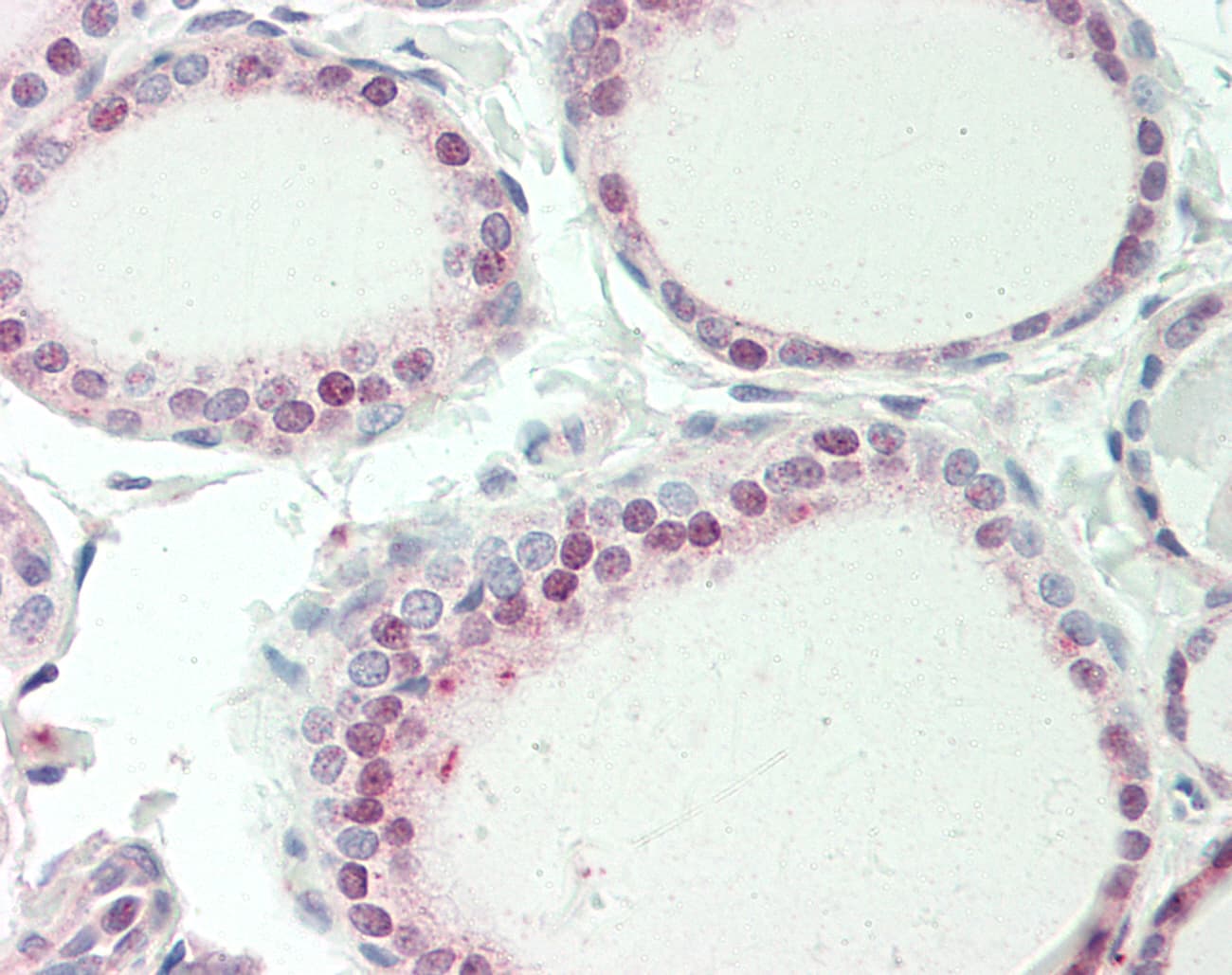 Polyclonal Rabbit anti-Human SPG21 / MAST Antibody (C-Terminus, IHC, WB)