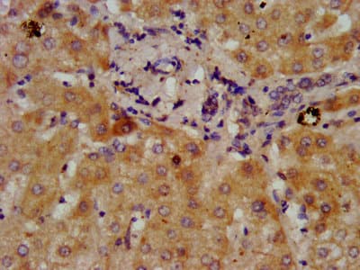 DMGDH Antibody