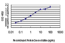 Monoclonal Mouse anti-Human LLGL2 Antibody (clone 4G2, WB)