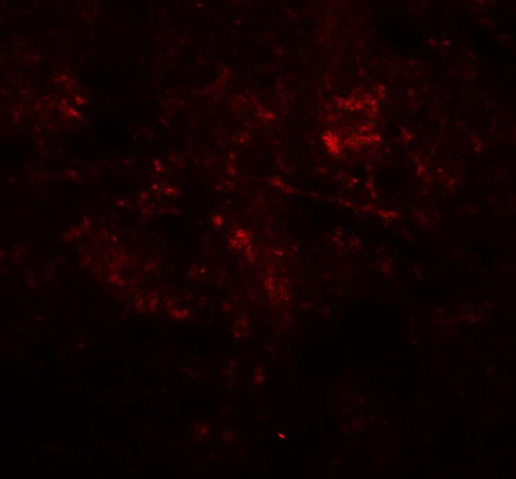 IHC-plus™ MEK1 + MEK2 Antibody