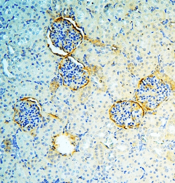 ANXA3 / Annexin A3 Antibody