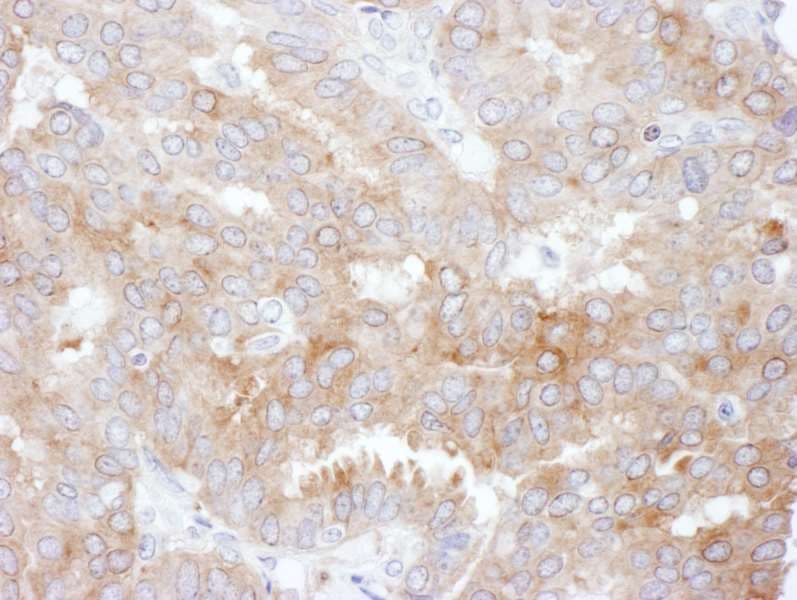 SLC9A3R1 / NHERF1 / EBP50 Antibody (aa325-358)