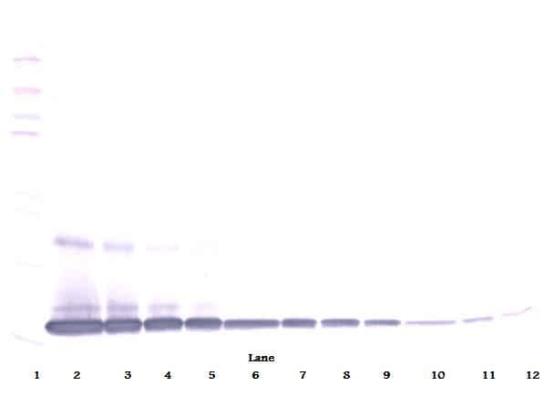 IL1A / IL-1 Alpha Antibody