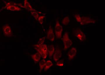CPT1B Antibody